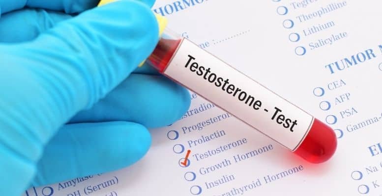 Testosterone levels